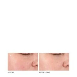 Dr Dennis Gross Alpha Beta Pore Perfecting And Refining Serum -Beauty Shop Alpha Beta Pore Perfecting and Refining 65306 7635 general